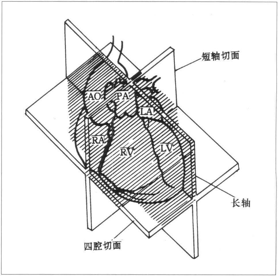 常用標(biāo)準(zhǔn)心臟超聲切面